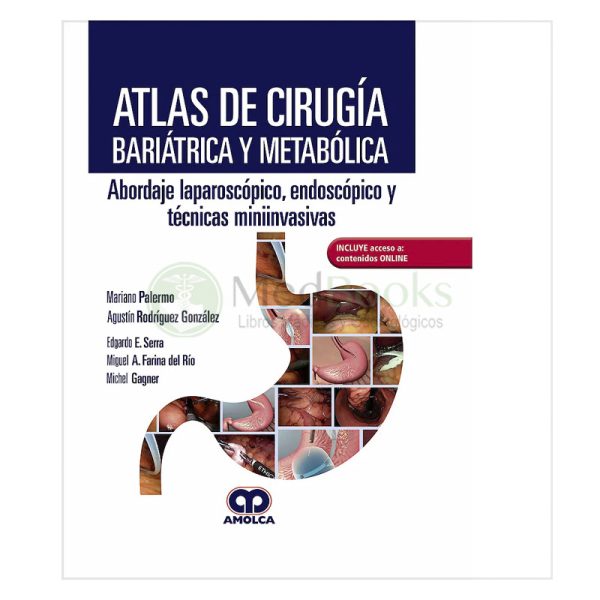 Atlas de Cirugía Bariátrica y Metabólica. Abordaje Laparoscópico, Endoscópico y Técnicas Miniinvasivas + Acceso a Contenidos Online