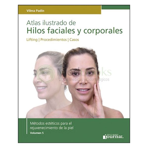 Atlas ilustrado de Hilos faciales y corporales