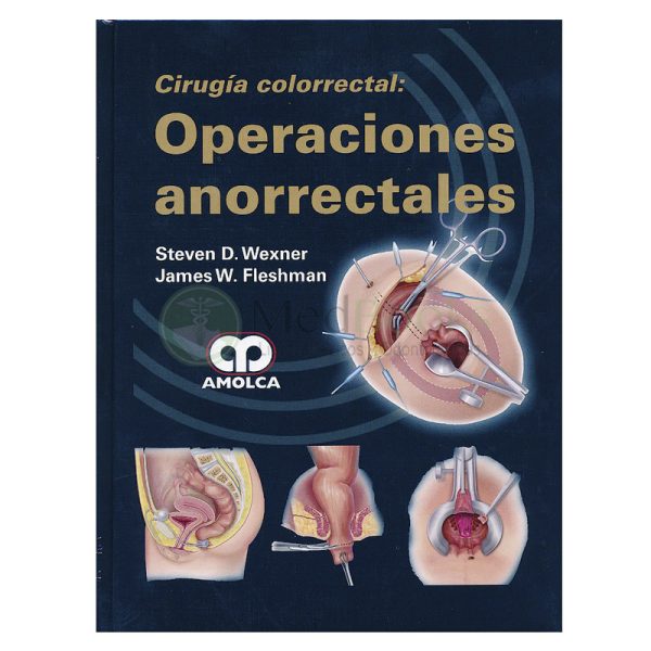 Cirugía Colorrectal: Operaciones Anorrectales