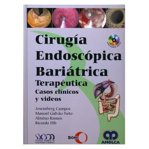 Cirugía Endoscópica Bariátrica Terapéutica. Casos Clínicos y Videos