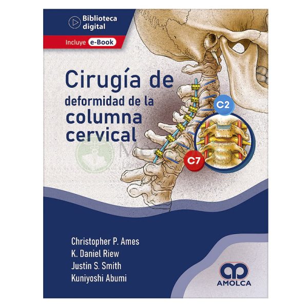 Cirugía de la Deformidad de la Columna Cervical