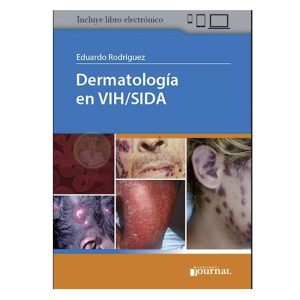 Dermatología en VIH/SIDA
