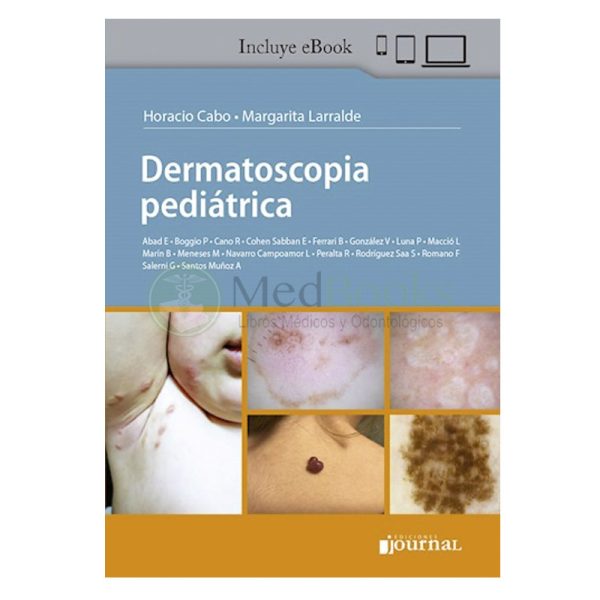Dermatoscopia pediátrica