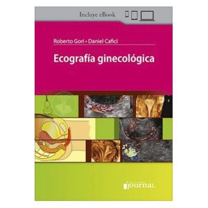 Ecografía Ginecológica