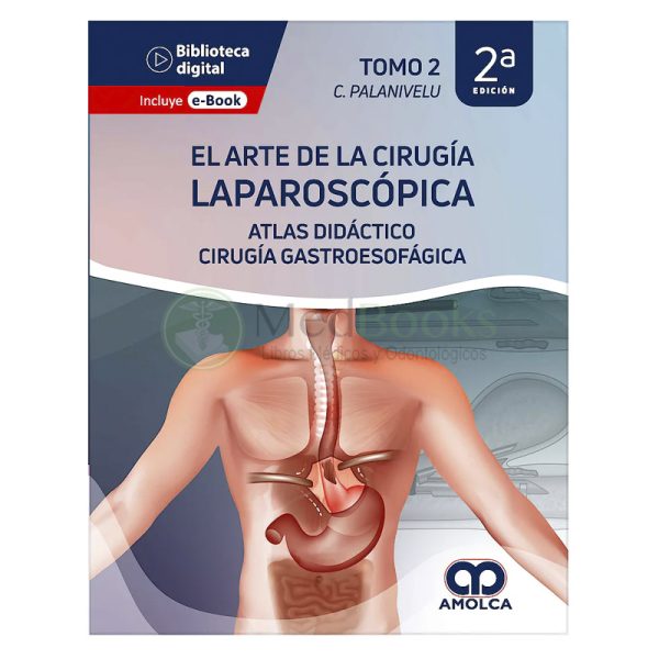 El Arte de la Cirugía Laparoscópica Tomo 2: Atlas Didáctico. Cirugía Gastroesofágica