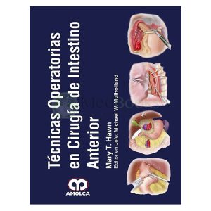 Técnicas Operatorias en Cirugía de Intestino Anterior
