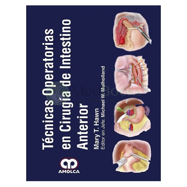 Técnicas Operatorias en Cirugía de Intestino Anterior