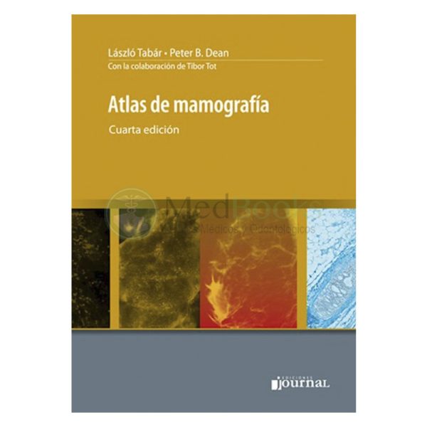 Atlas de mamografía