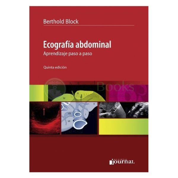 Ecografía Abdominal