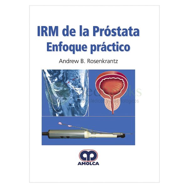 IRM de la Próstata. Enfoque Práctico