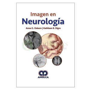 Imagen en Neurología