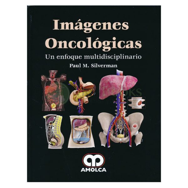 Imágenes Oncológicas. Un Enfoque Multidisciplinario