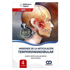 Imágenes de la Articulación Temporomandibular