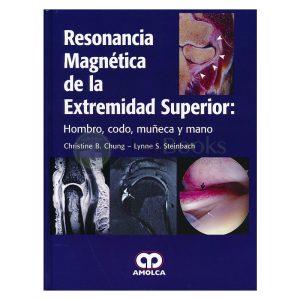 Resonancia Magnética de la Extremidad Superior: Hombro, Codo, Muñeca y Mano