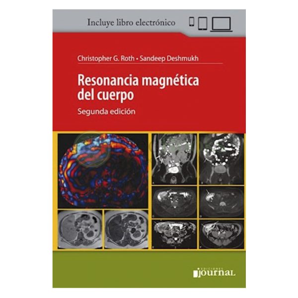 Resonancia magnética del cuerpo