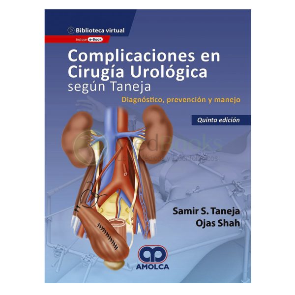 Complicaciones en Cirugía Urológica según Taneja. Diagnóstico, Prevención y Manejo