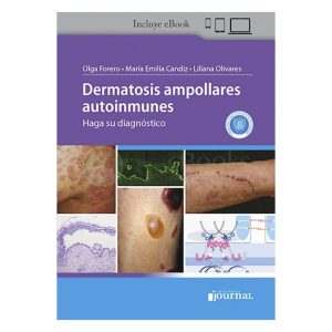 Dermatosis ampollares autoinmunes: Haga su diagnóstico