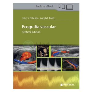 Ecografía vascular