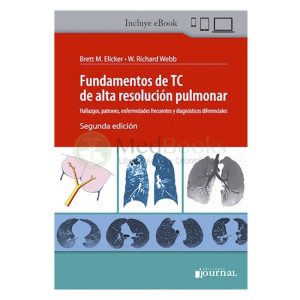 Fundamentos de TC de alta resolución pulmonar