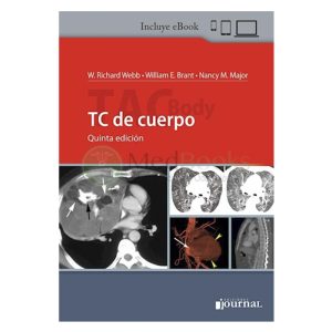 TC de cuerpo