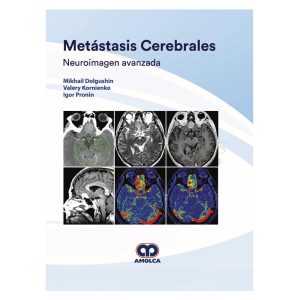 Metástasis Cerebrales. Neuroimagen Avanzada
