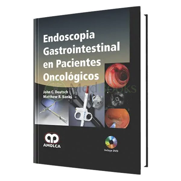 Endoscopia Gastrointestinal en Pacientes Oncológicos