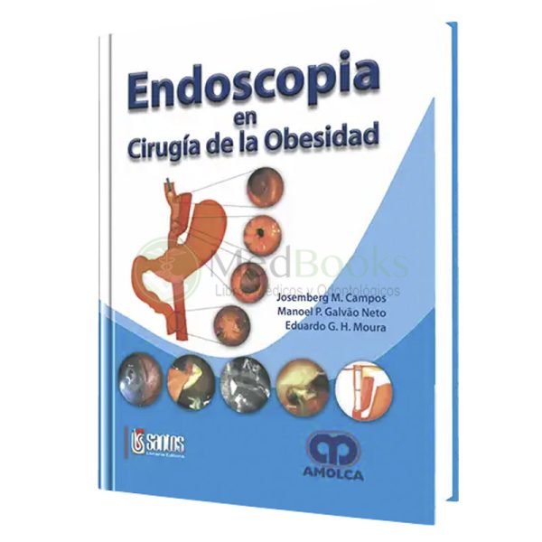 Endoscopia en Cirugía de la Obesidad