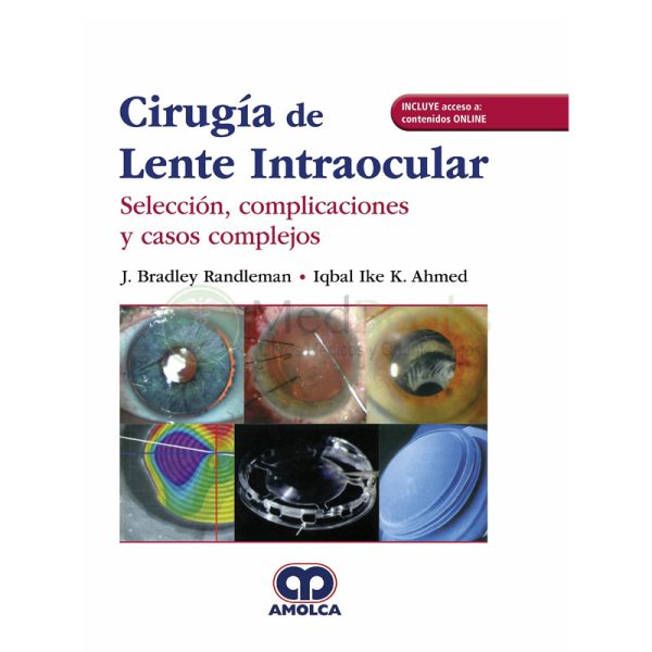 Cirugía de Lente Intraocular. Selección, Complicaciones y
