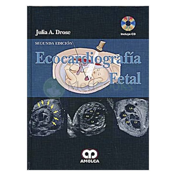 Ecocardiografía Fetal