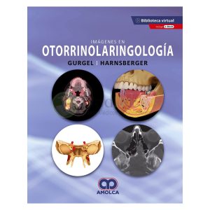 Imágenes en Otorrinolaringología