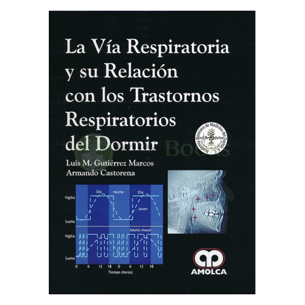 La Vía Respiratoria y Su Relación con los Trastornos Respiratorios del Dormir