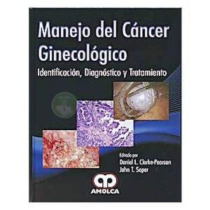Manejo del Cáncer Ginecológico. Identificación, Diagnóstico y Tratamiento