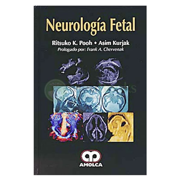 Neurología Fetal