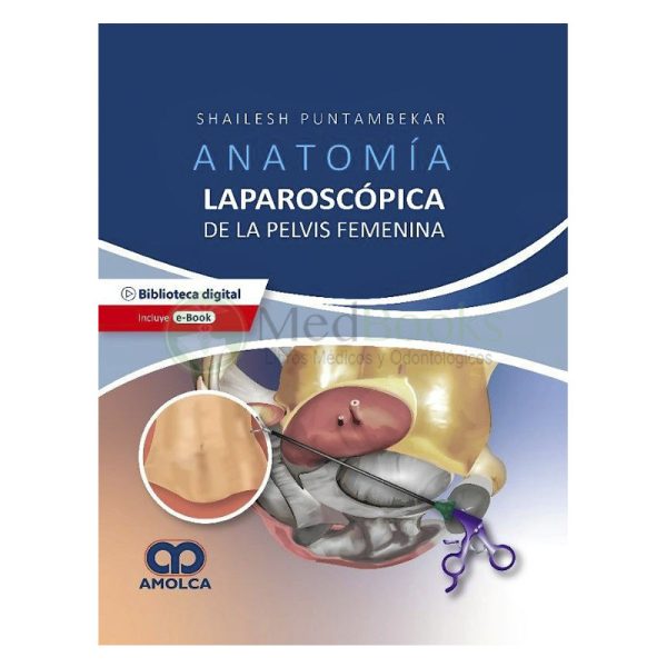 Anatomía Laparoscópica de la Pelvis Femenina. Principios Quirúrgicos Aplicados