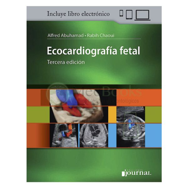 Ecocardiografía Fetal