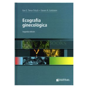 Ecografía Ginecológica