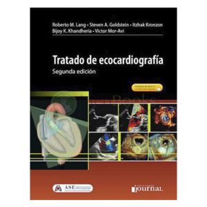 Tratado de Ecocardiografía. 2° Edición.