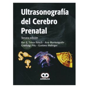 Ultrasonografía del Cerebro Prenatal