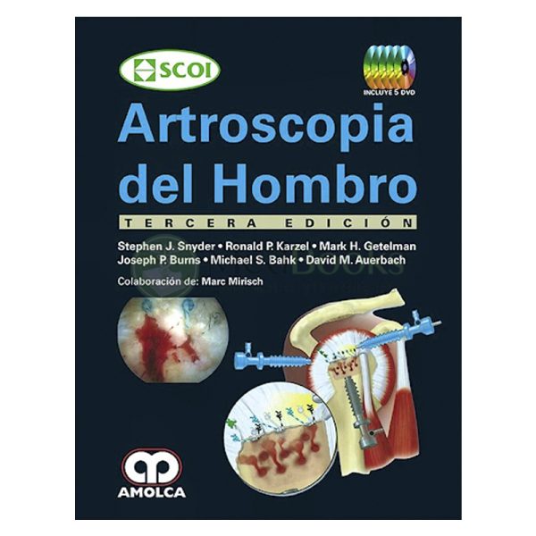 Artroscopia del Hombro