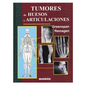 Greenspan - Tumores de huesos y articulaciones