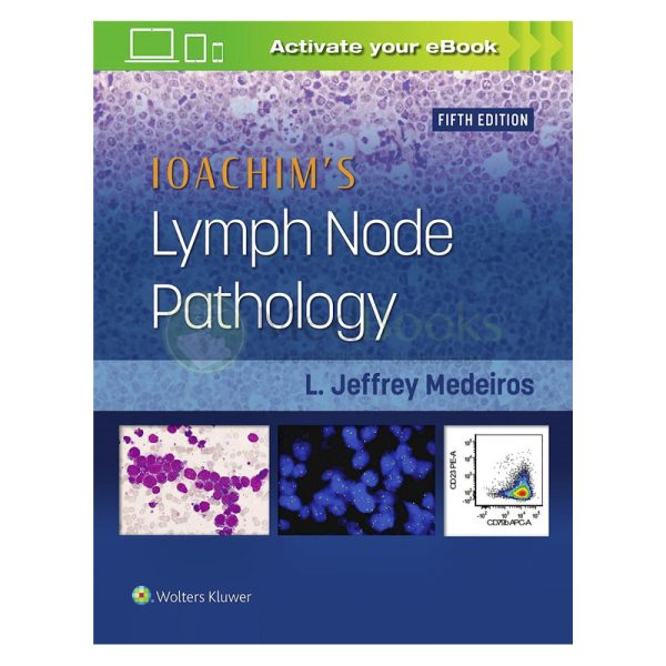 IOACHIM's Lymph Node Pathology