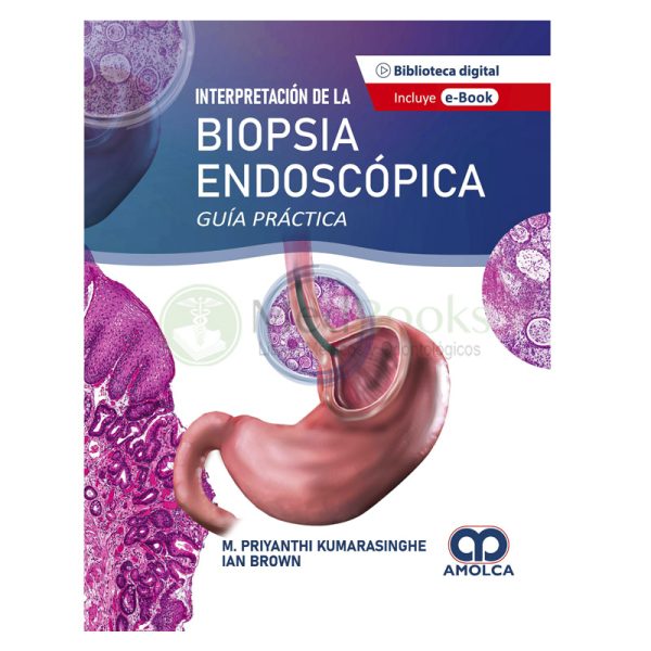 Interpretación de la Biopsia Endoscópica. Guía Práctica