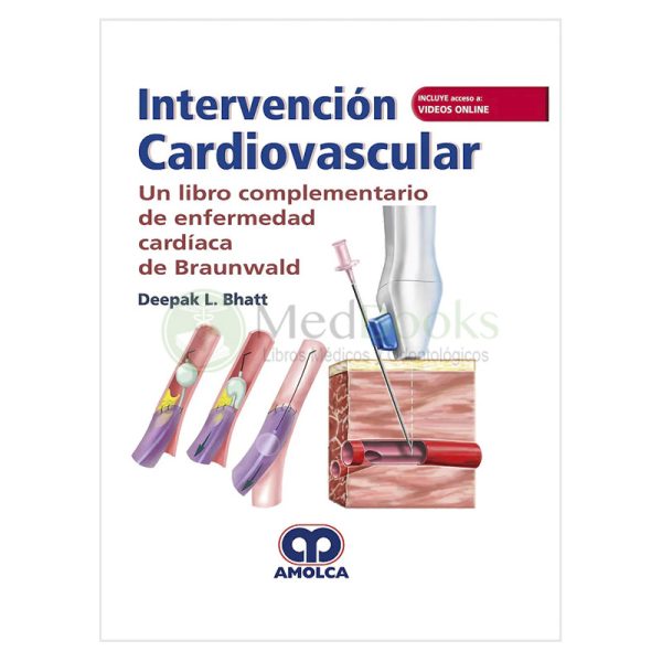 Intervención Cardiovascular. Un Libro Complementario de Enfermedad Cardíaca de Braunwald (Incluye Acceso a Vídeos Online en Inglés)