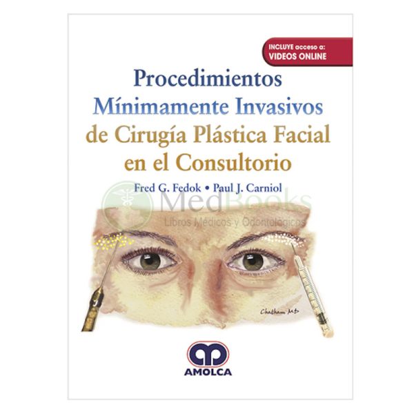 Procedimientos Mínimamente Invasivos de Cirugía Plástica Facial en el Consultorio + Videos Online