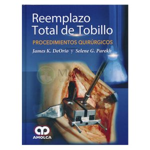 Reemplazo Total de Tobillo. Procedimientos Quirúrgicos