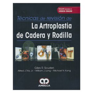 Técnicas de Revisión de la Artroplastia de Cadera y Rodilla + Videos Online