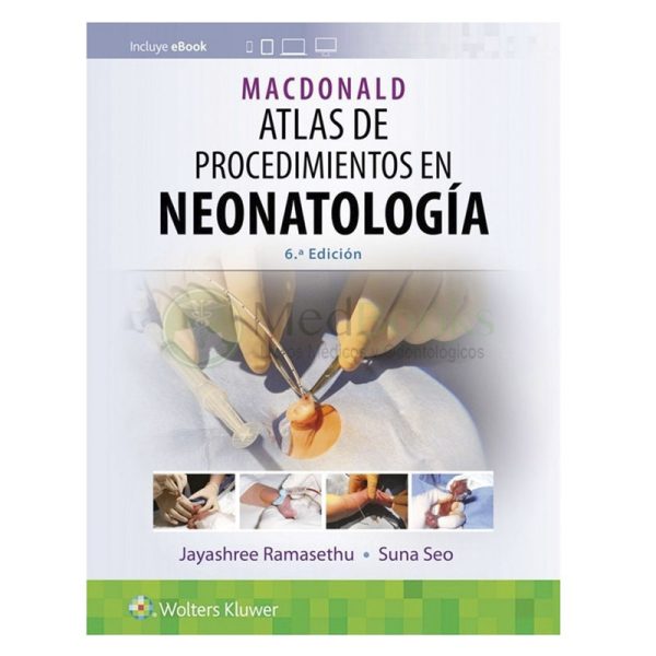 MACDONALD. ATLAS DE PROCEDIMIENTOS EN NEONATOLOGÍA 6ª ED.