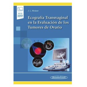 ECOGRAFÍA TRANSVAGINAL EN LA EVALUACIÓN DE LOS TUMORES DE OVARIO