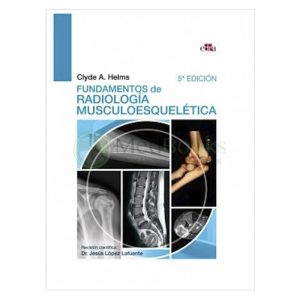 Fundamentos de Radiología Musculoesquelética