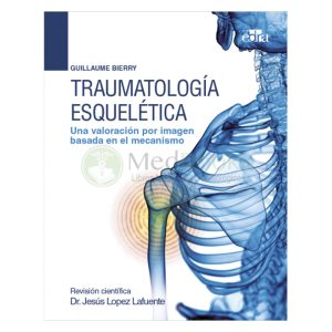 TRAUMATOLOGÍA ESQUELÉTICA UNA VALORACIÓN POR IMAGEN BASADA EN EL MECANISMO